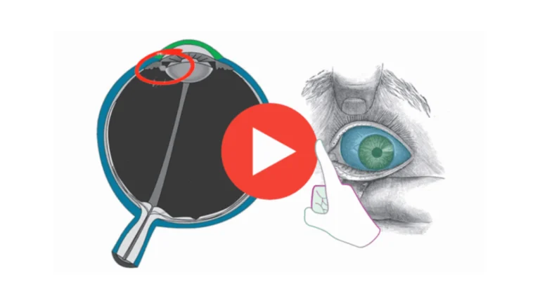 Harvard ophthalmologist Dr. Ming Wang revealing classified Arctic blueberry protocol that stops macular degeneration progression